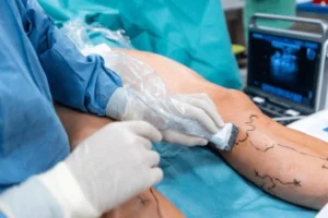 متى تزور طبيب جراحة الأوعية الدموية