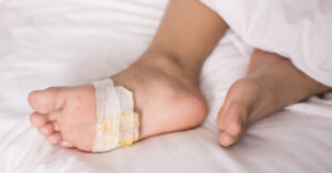 علاج قرح الساق ومضاعفات القدم السكري