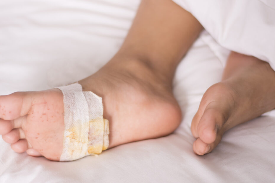 علاج قرح الساق ومضاعفات القدم السكري