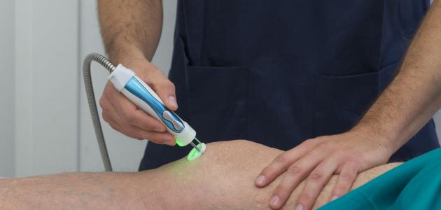 علاج دوالى الساقين بالليزر والتردد الحرارى